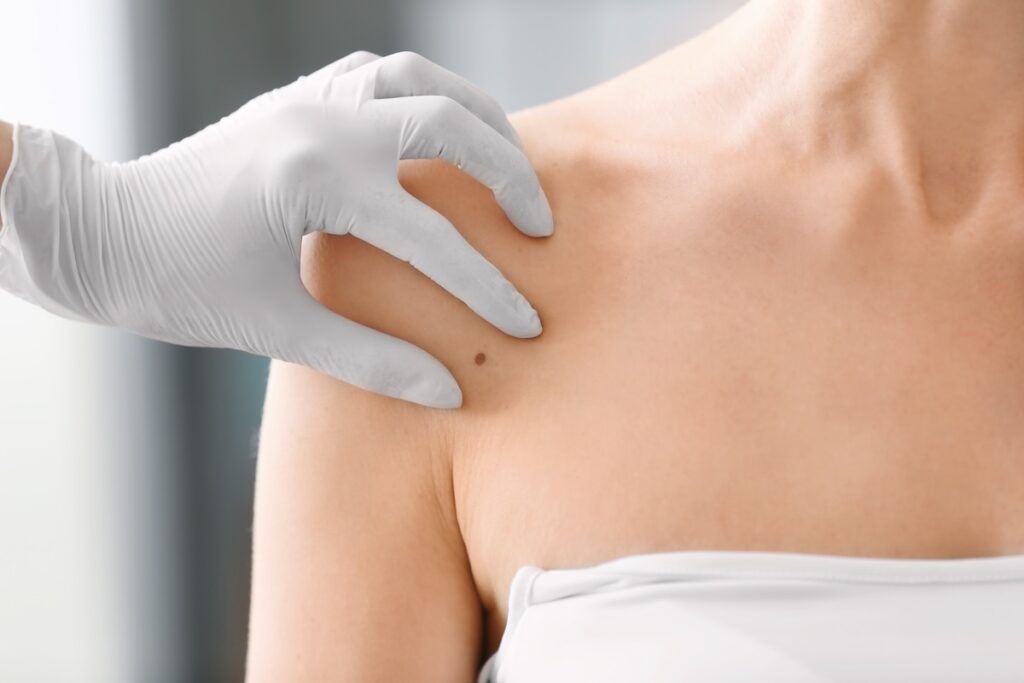 A Dermatologist’s Guide to Skin Cancer Awareness